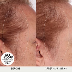 Give your scalp room to bloom. A OUAI healthier scalp is the key to longer, fuller, healthier-looking hair. Shop new Scalp Serum. | OUAI