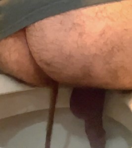 Can’t stop shitting liquid diarrhea