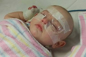 Up 100 children are born with cataracts in Australia each year. Scientists have made a discovery that could help young and old with the condition. | ABC News