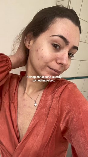 Can we not talk about that right ？ 🥹 #acne #chestacne #SelfLove #real.. | Funny Funny 5 M