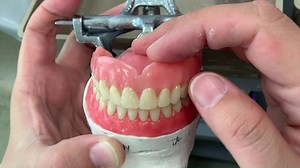 Finished Max and wax try in lower... | LSK121 Oral Prosthetics
