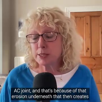 21 reactions | What do patients with rotator cuff tear arthropathy report, and what will you see in these patients? | Clinical Edge | Facebook