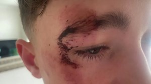 Shocking moment pupils are 'crushed' at school gate as one child reveals how he suffered two black eyes 'from other students' shoes'