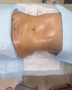 We are the queens when it comes to the cosmetic world. Call us today for your appointment ☎️ 946-618-9915 #fyp #fypシ #followforfollowback | NOBU Medical Spa