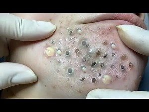 Achieve inner peace with these facial cleansing meth