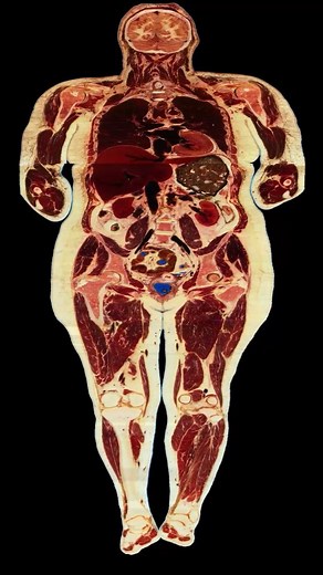 Kent | This video was compiled using photographic medical data from the Visible Human Project The original dataset from the Visible Woman project... | Instagram