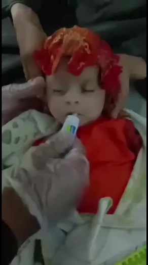 NG tube placement on infant 🩺📝📝 Video credit nisar Khan #paknursesdiaries | Pak Nurses Diaries