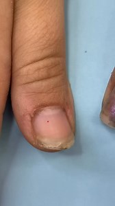 Wide triangle ????nails transformation ???? | Realityshow