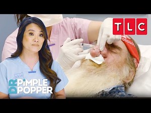 All the Pops from Season 6 | Dr. Pimple Popper | TLC