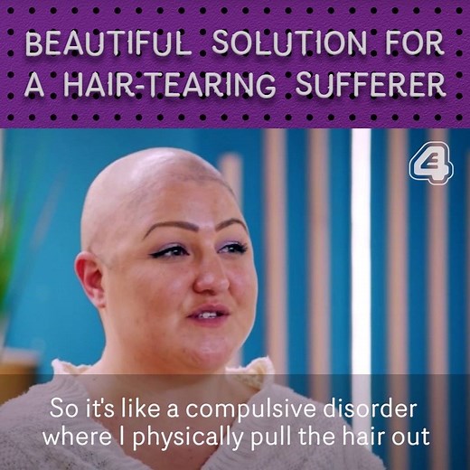 An incredible transformation for a compulsive hair-puller. | E4