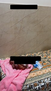 409K views · 3.6K reactions | A baby passes acidic stools which can cause excoriation of skin around the anal area. The treatment of this is explained very well. #doctor #excoriation #acidicstools#nappyreaction | Patiala Hospital | Facebook