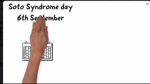 32 reactions | Join us in commemorating Soto Syndrome Day. Special Olympics Pakistan (SOP) athlete and Global Athlete Input Council representative Jasmine Sharif created this video to share her story. #ChooseToInclude | Special Olympics | Facebook