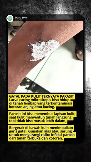 Itchy Skin Caused by Parasites