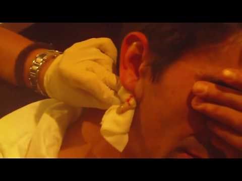 Bouton enorme ame sensible s'abstenir