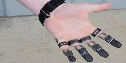 These 13 medical technologies are changing lives