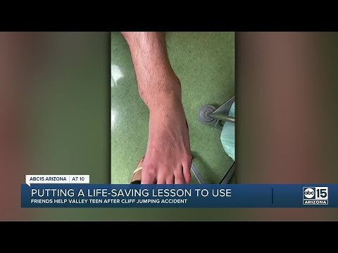Valley teens use 'Stop the Bleed' training after friend breaks legs cliff jumping