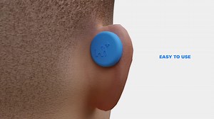 Professional Mixed Martial Artists and Brazilian Jiu-Jitsu Competitors trust CauliBuds to treat cauliflower ear. $55.00 | CauliBuds
