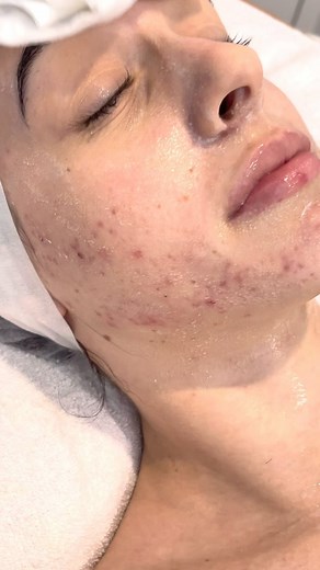 The facts ⬇️⬇️⬇️ Excessive sugar intake may contribute to...