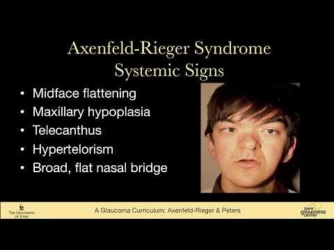 Axenfeld-Rieger Syndrome, Peter anomaly