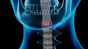Nodular Goiter In Human Body 3d Render Stock Motion Graphics SBV-338591633 - Storyblocks