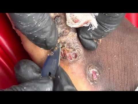 Jigger digging Buda’s left foot - subscribe now @riseupsociety.net to watch FULL VIDEO