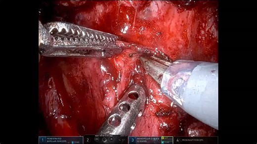 ROBOTIC RPLND ABSTRACT VIDEO