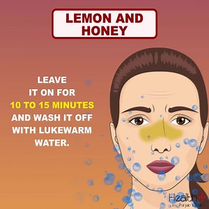 4 Natural Ways to Clear Blackheads #drNAS #socialawareness #humanwelfare #humansafety #Bkackheads #SkinCare | Dr Naveed Ahmed Shaikh