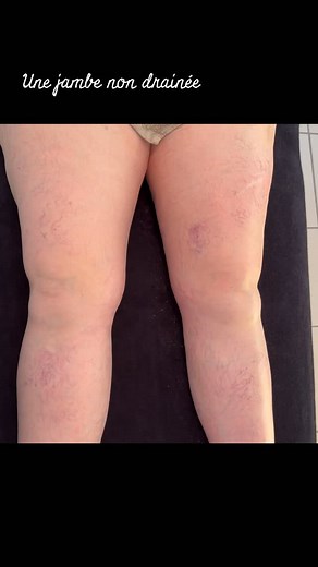 14K views · 92 reactions | Tu veux comprendre pourquoi cette jambe...