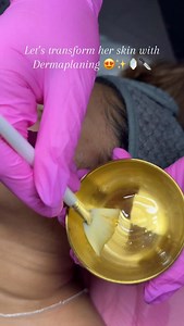 25K views · 6.1K reactions | If you’re not dermaplaning… then wyd?? ✨ Let’s transform her skin with Dermaplaning for Glass Skin 爵 #dermaplaning #dermaplane #satisfying #hairremoval #facials #facialtreatment #dermaplaningfacial #longisland #newyork #hicksville #longislandnewyork #esthetician #glassskin #glowingskin #skintransformation #estheticianlife #skin #skincare #medspa | Michelle Hashimi | Facebook
