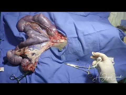 CIRUGIA DE PIOMETRA CANINA