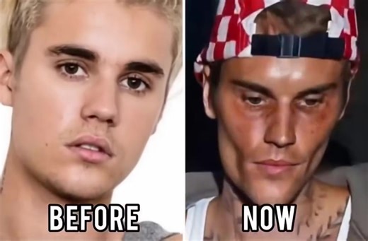 梁Justin Bieber admits that he tested positive for…See More… | IBMS Model Management | Facebook