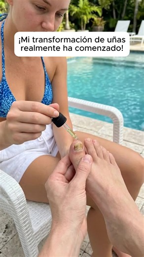 Nail Fungus Treatment & Nail Care Shop Mother's Day Gift