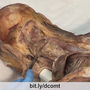 2.6K views · 73 reactions | The four muscles of the suboccipital...