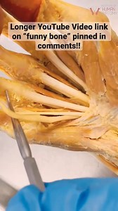 23K views · 496 reactions | When Hitting the Real “Funny Bone” Isn't So Funny#humen #body #fitness #fit #abs #healthy #gymlife #life #Doctor #reels #shorts | Human Anatomy | Facebook