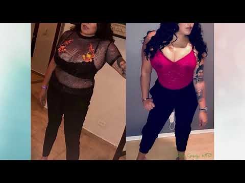 Vital Connection MD explains how fun sculpting works