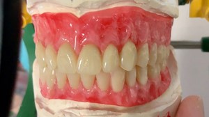 Full mouth wax try in for LSK Deluxe Denture! Sending to Dr Craig Rothenberg in New Hampshire! Vanguard Dental | LSK121 Oral Prosthetics
