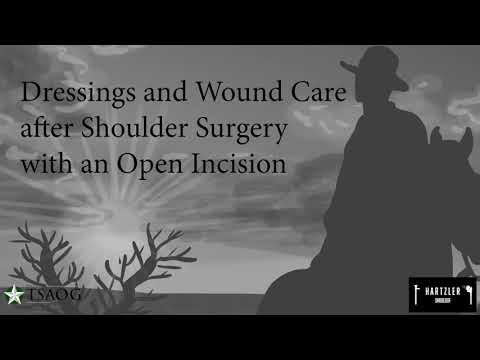 Dressings and Wound Care after "Open" Shoulder Surgery (larger incisions)