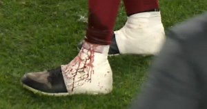 Alex Smith's Leg Was Completely Drenched In Blood During Game vs. Steelers (VIDEO)