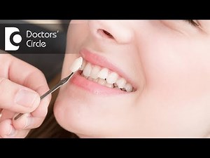 What are the types of Dental Crowns? - Dr. Jayaprakash Ittigi