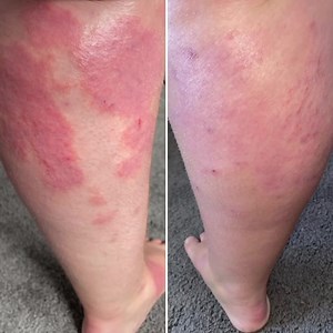 8.8K views | Have you met our Super Heroes products? A combination of 3 holy grail products: ✨Glory Oil ✨Coconut Body Milk ✨Pink Himalayan Salt Scrub ✨Free Exfoliating Mitt On a mission to resurrect inflamed irritated skin. Don’t take our word for it, check out the mind blowing reviews. | Eco By Sonya | Facebook