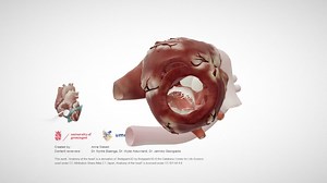 Cardiac Anatomy: Parasternal Short Axis Apex - Download Free 3D model by E-learning UMCG (@eLearningUMCG)