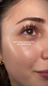 Cloves, Chamomile & Lemon for Clear Skin | Acne Prone Skin Tips