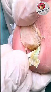 244K views · 1.1K reactions | Smart Nail Care Tips for Everyday Nail Comfort ️ #SimpleNailCare #HealthyNails #DailyRoutine | Danish irshad fans | Facebook