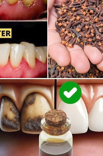 Unlock the Secret to Healthier Teeth with the Oral Care Benefits of Chewing Cloves Daily....𝐑𝐞𝐚𝐝 𝐦𝐨𝐫𝐞💬👀👇 | Sage & Reid