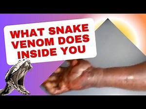 This is What REALLY Happens to Your Body When a Venomous Snake Bites You