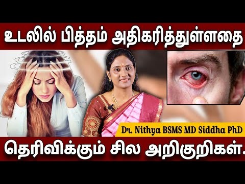 பித்தம் குறைய | பித்த மயக்கம் நீங்க இதை குடித்தால் போதும் | Pitham #dr_nithya #ssc