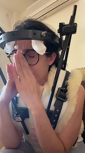 Día 4 de halo cervical: manejo del dolor de cabeza