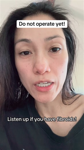 If you have fibroids listen first before you undergo operation! | Dr. Farrah Agustin-Bunch, MD