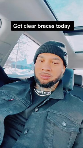 #fyp #braces #2022 #clearbraces