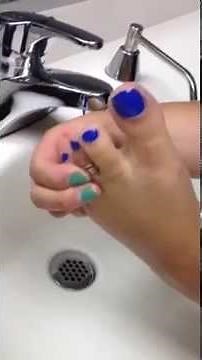 Trying to get toe ring off foot